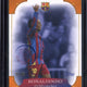 2025 Topps FC Barcelona 125th Anniversary Ronaldinho Forever Moments /25 FM-4